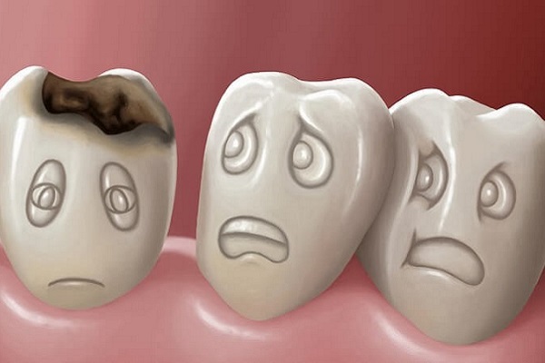 Причины зубной боли и как ее лечить в домашних условиях