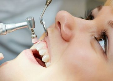 Профессиональная гигиена полости рта Air Flow в Калининграде