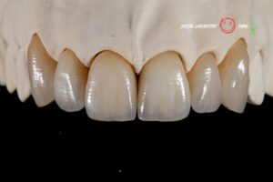 Протезирование зубов в Калининграде